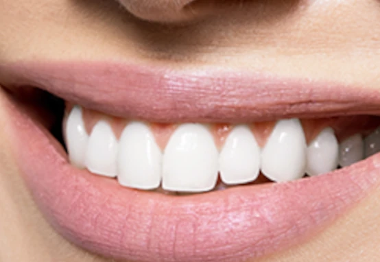 ครอบฟันและสะพานฟัน