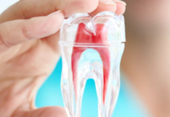 รักษารากฟัน