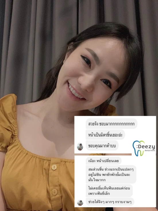 จัดฟันขอนแก่น, จัดฟันอุดรธานี, จัดฟันอุบลราชธานี รีวิว 13 จัดฟันขอนแก่น, จัดฟันอุดรธานี, จัดฟันอุบลราชธานี รีวิว 13