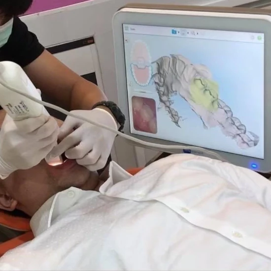 จัดฟันขอนแก่น, จัดฟันอุดรธานี, จัดฟันอุบลราชธานี รีวิว 17 จัดฟันขอนแก่น, จัดฟันอุดรธานี, จัดฟันอุบลราชธานี รีวิว 17